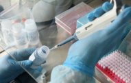 Koronavirusun diaqnostikası üçün testlər Azərbaycana gətirilib 