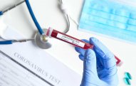 İrandan qayıdan daha iki azərbaycanlıda koronavirus aşkarlandı