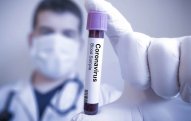 Azərbaycanda 25 nəfərdə koronavirus aşkarlanıb, 560 nəfər karantindədir