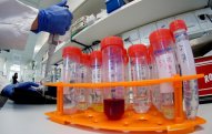 Çində koronavirus qurbanlarının sayı 3,3 min nəfərə çatır