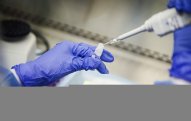 Ölkədə koronavirusa görə 30 minə yaxın insan test edildi  