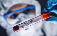 Azərbaycanda daha 105 nəfərdə koronavirus aşkarlanıb
