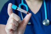 Koronavirus pandemiyası hələ pik nöqtəyə çatmayıb - ÜST