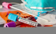 Almaniyada koronavirusdan ölənlərin sayı 4,1 mini keçdi 