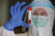 Azərbaycanda daha 38 nəfər koronavirusa yoluxub, 42 nəfər sağalıb 