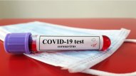 Gürcüstanda koronavirusa yoluxanların sayı 600-ü ötdü