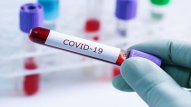 Dünyada son sutkada koronavirusa yoluxanların STATİSTİKASI