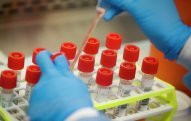 Bu ölkələrdə koronavirus qeydə alınmayıb - SİYAHI
