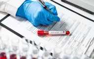 Ermənistanda bir sutkada rekord sayda yoluxma qeydə alınıb