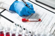 Deputatların koronavirus testinin nəticələri açıqlandı 