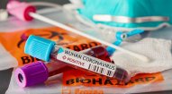 Gürcüstanda koronavirusa yoluxanların sayı 980-i ötdü 