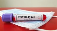 Ermənistanda koronavirusa yoluxanların sayı 39 mini ötdü 