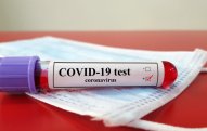 Azərbaycanda daha 226 nəfər COVID-19-a yoluxub, 588 nəfər sağalıb 