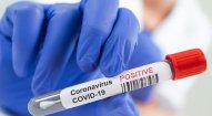 Gürcüstanda koronavirusa yoluxanların sayı 25 nəfər artdı 