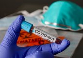 Gürcüstanda daha 9 nəfər koronavirusa yoluxub 