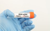 Koronavirusdan ölüm sayında rekord qeydə alındı 