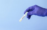 Azərbaycanda daha 802 nəfərdə koronavirus aşkarlanıb, 31 nəfər ölüb