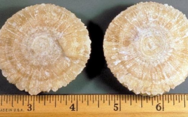 Böyrək daşlarından əziyyət çəkənlər       ekrana yaxın oturun 