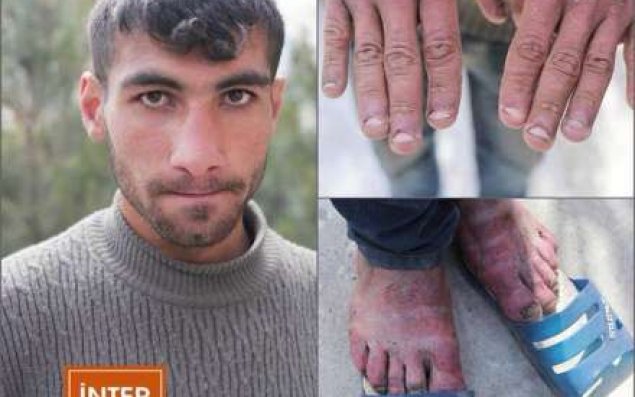 Xilaskar fəhlə FHN-ə işə götürülsün  Deputat