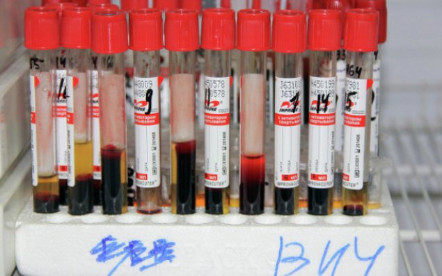 Azərbaycanda İİV-ə yoluxanların sayı 4332 nəfərə çatdı