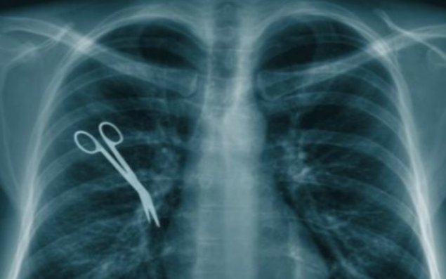 Həkimlərin dəhşətli səhvi 5 il sonra üzə çıxdı   - Xəstənin qarnında... 