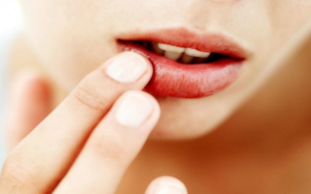 Çatlayan dodaqlar üçün vanilli balzam