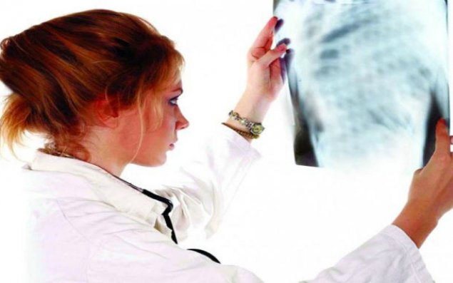 Vərəmə qarşı yeni mübarizə proqramı qəbul olundu