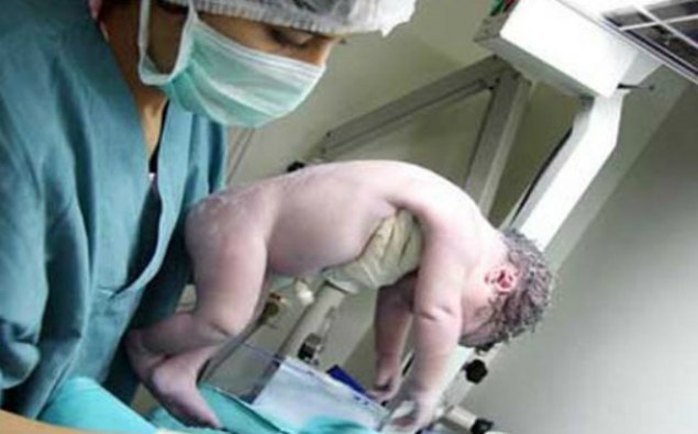 Bərdədə yeni doğulan uşağın ölüm səbəbi - “Uşaq çoxlu maye udub”