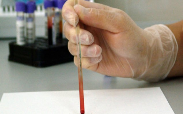 Pulsuz dərmanla təmin edilən hepatitli xəstələrin sayı açıqlandı