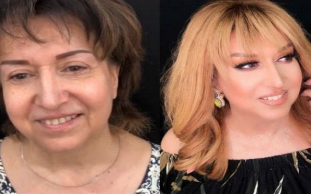 Əməkdar artisti heç vaxt belə görməmisiniz – VİDEO