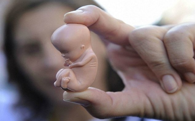 İrlandiya parlamenti abortları leqallaşdırdı