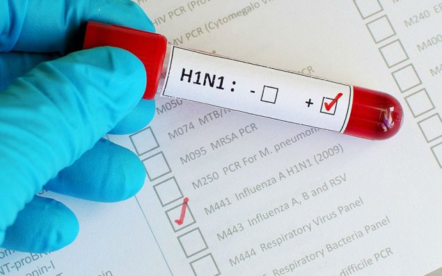 Mərkəz rəhbəri: “Gürcüstanda qriplə bağlı epidemiya təhlükəsi yoxdur”