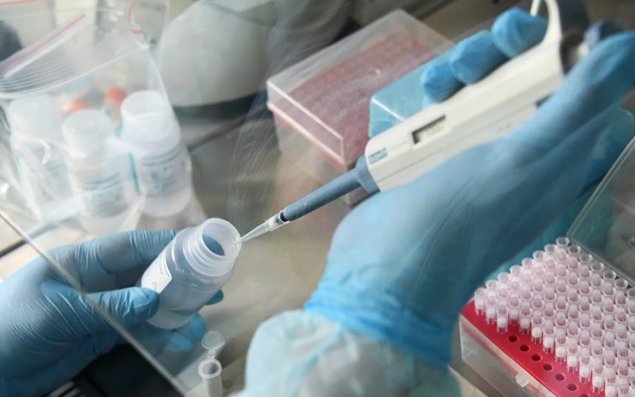 Koronavirusun diaqnostikası üçün testlər Azərbaycana gətirilib 