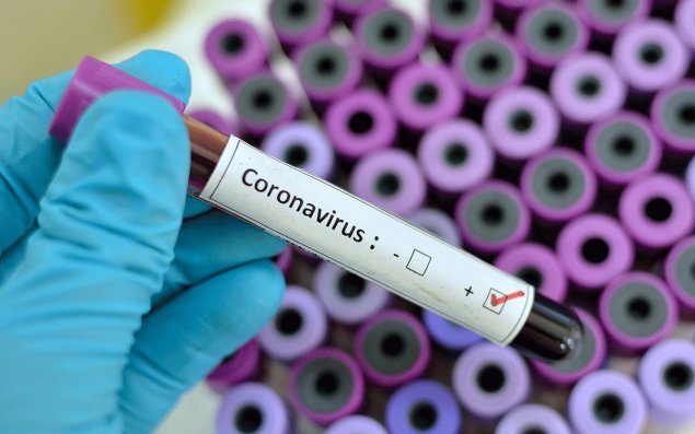 Gürcüstanda koronavirusun aşkarlanması ilə bağlı Azərbaycandan rəsmi açıqlama