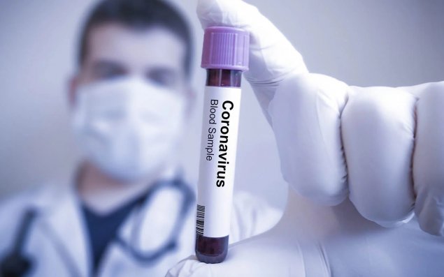 Azərbaycanda daha 2 nəfərdə koronavirus aşkarlanıb