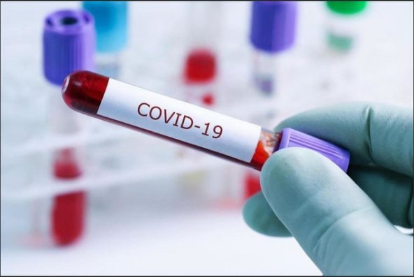 Gürcüstan azərbaycanlıları koronavirus testindən keçiriləcək