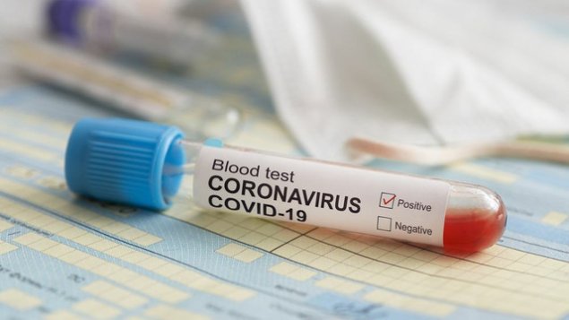 Dünyada koronavirusa yoluxanların sayı 1,6 milyonu ötdü  