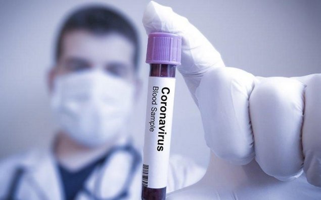 Dünyada koronavirus qurbanlarının sayı 290 mini ötdü