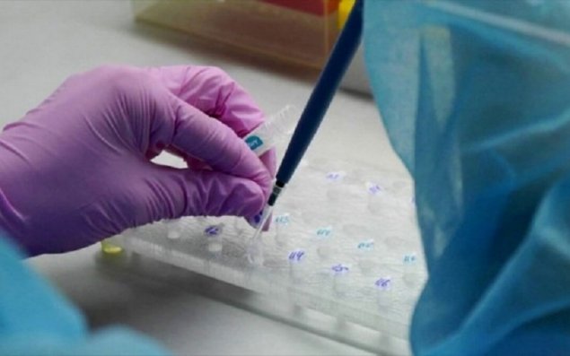 Dünyada koronavirusa yoluxanların sayı 5,5 milyonu ötdü 