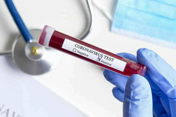 Almaniyada bir gündə koronavirusa 475 nəfər yoluxdu 