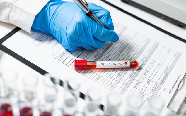 Deputatların koronavirus testinin nəticələri sabah açıqlanacaq 