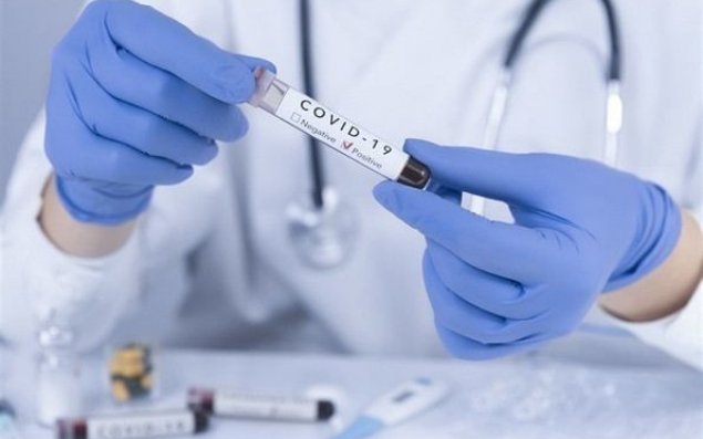 İndiyədək Azərbaycanda yarım milyondan çox koronavirus testi aparılıb 
