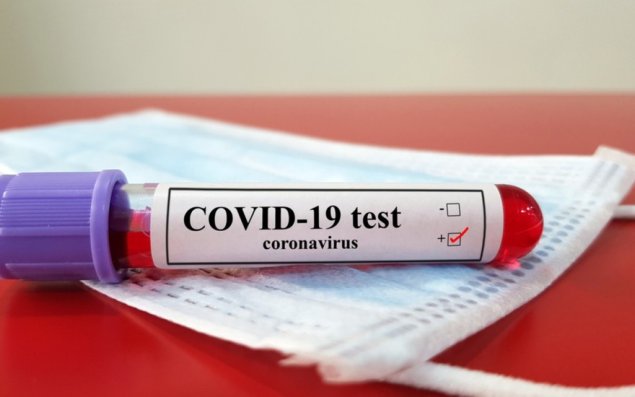 Azərbaycanda daha 226 nəfər COVID-19-a yoluxub, 588 nəfər sağalıb 