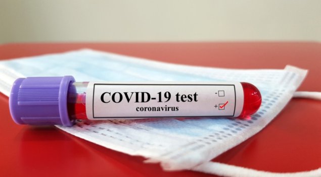 Azərbaycanda koronavirusa yoluxma sayı 150-dən aşağı düşüb, 435 nəfər sağalıb 