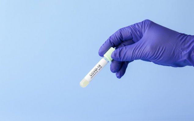 Azərbaycanda daha 802 nəfərdə koronavirus aşkarlanıb, 31 nəfər ölüb