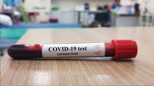 Koronavirusun yeni növü aşkar edildi