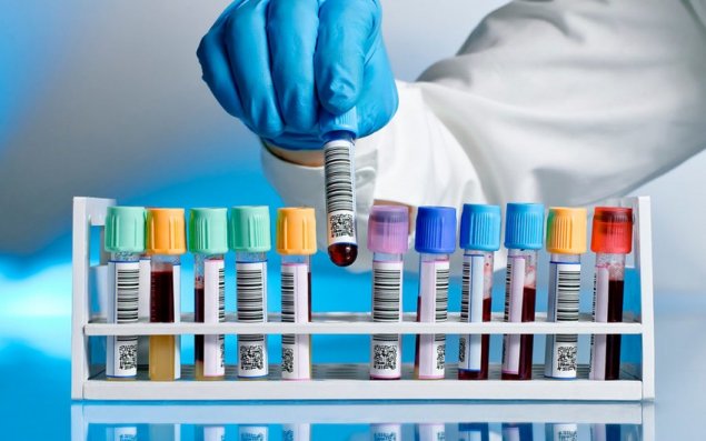 Azərbaycana yeni virusu aşkar edən testlər gətirildi
