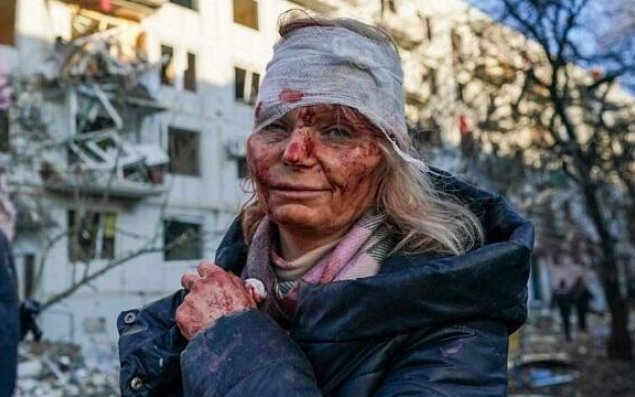 Rusiya və Ukrayna xalqları qardaşdır - Qaluzin