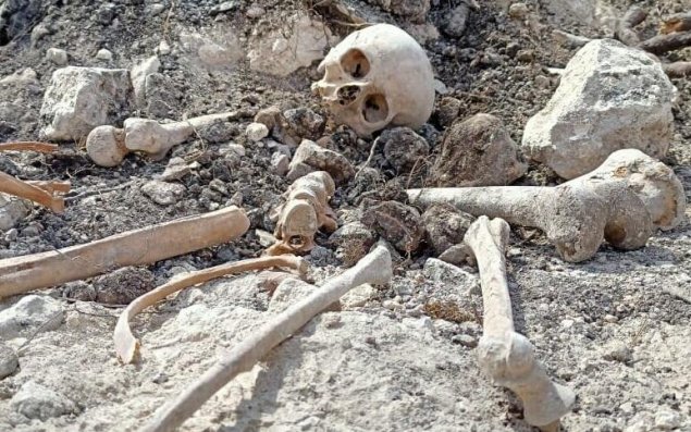 Ağdamda insan skeletinin qalıqları tapıldı