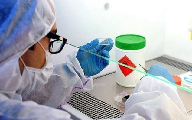 COVİD-19 vaksinləri ölümlərə səbəb olub – ABŞ-dan şok